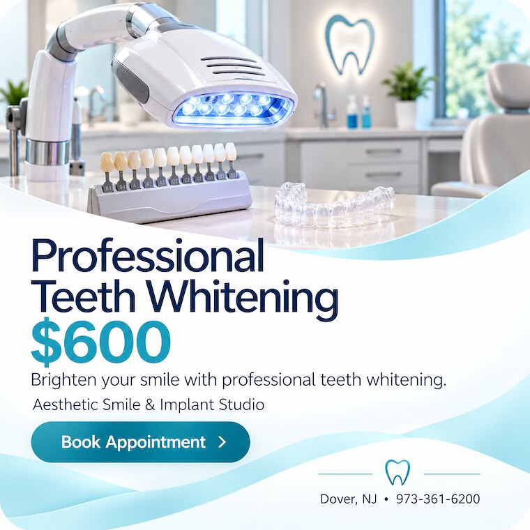 Professional Teeth Whitening &mdash; $600 at Aesthetic Smile & Implant Studio in Dover, NJ