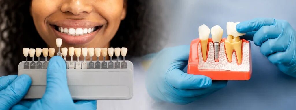 Shade guide colour matching and a dental crown model in Dover, NJ